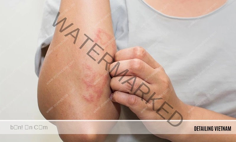 XU LY KICH UNG DA TAY DO DI UNG XA PHONG RUA XE 3